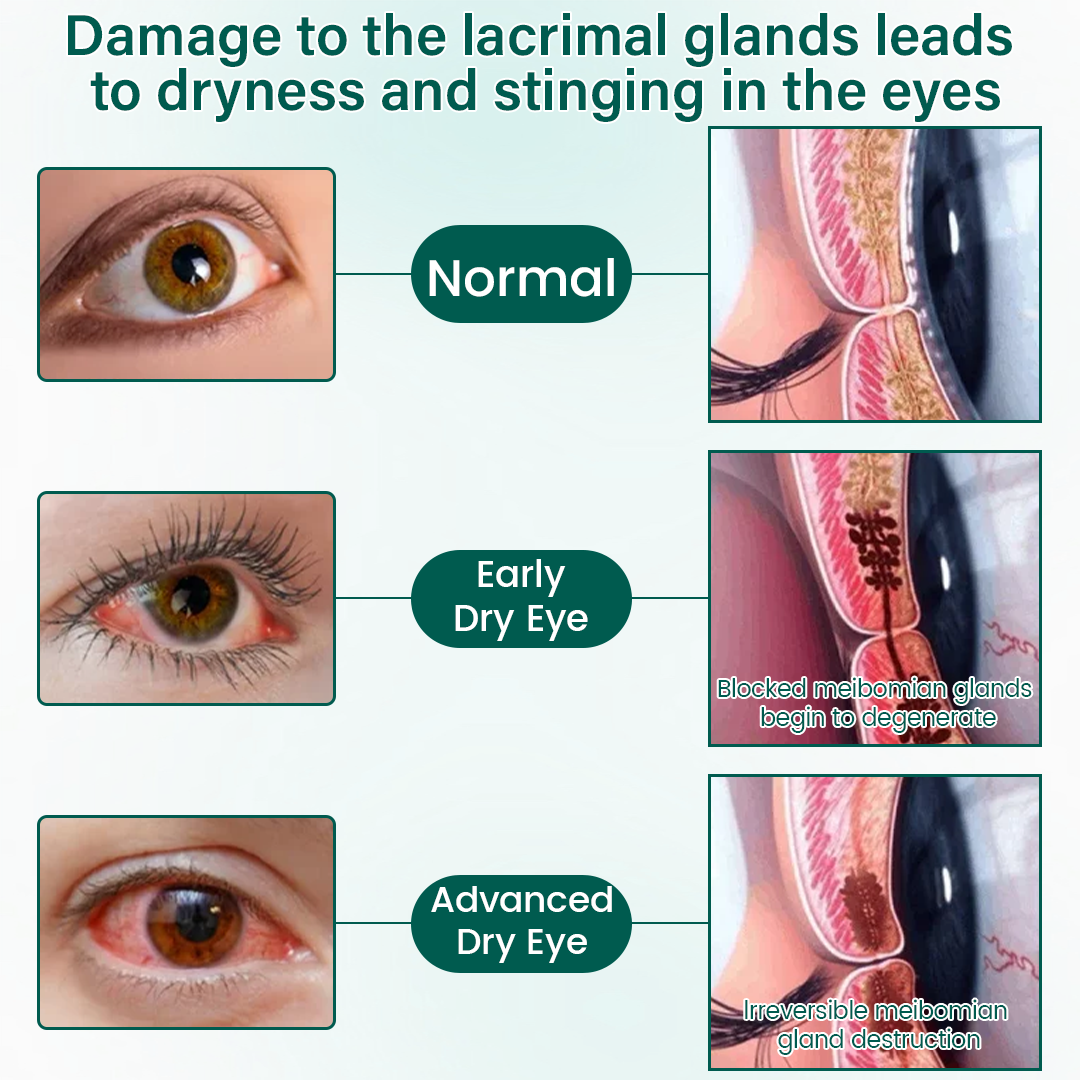 OptiClear Nano Eye Roller Serum