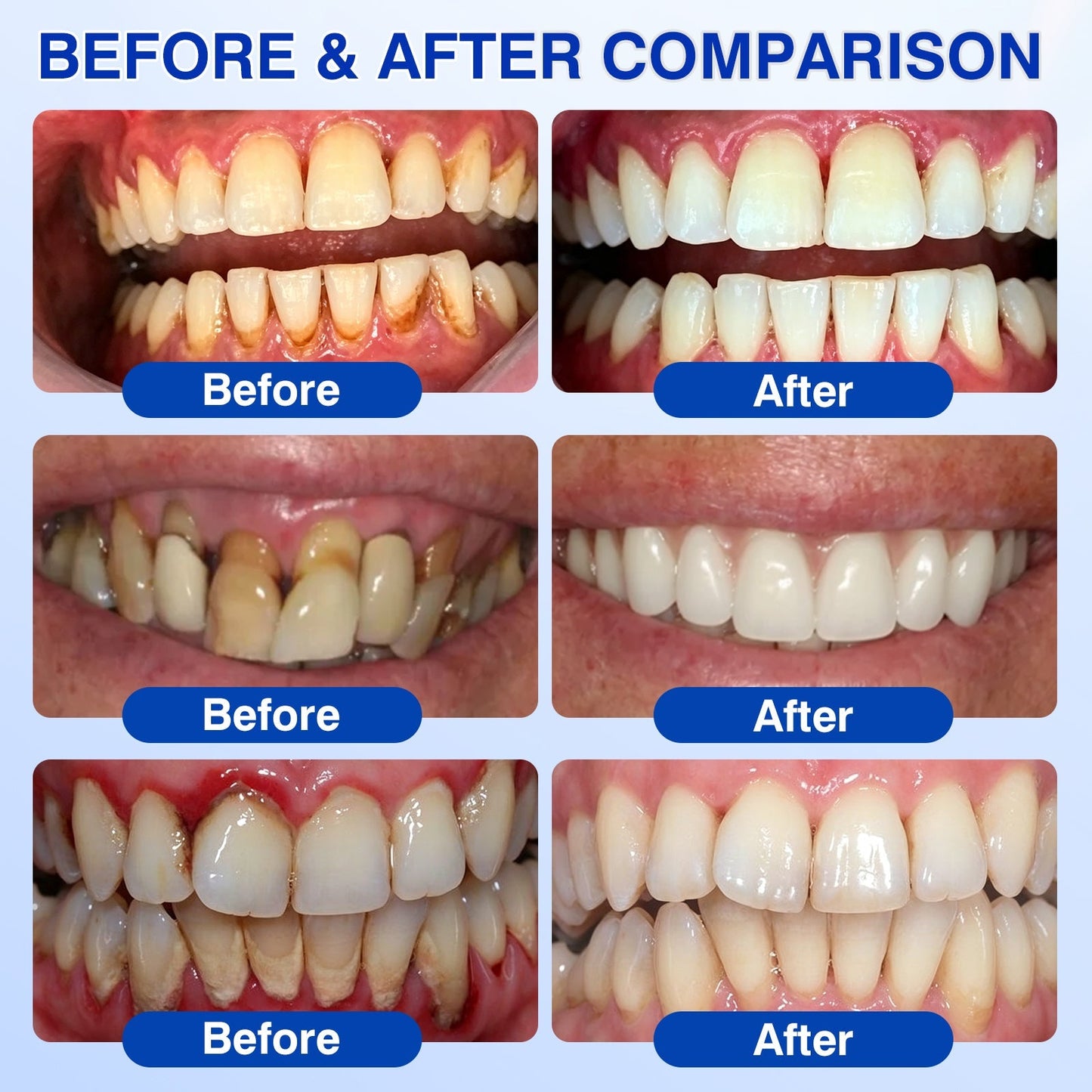 👨‍⚕️🦷🛡️GumRevive Periodontal Repair Gel