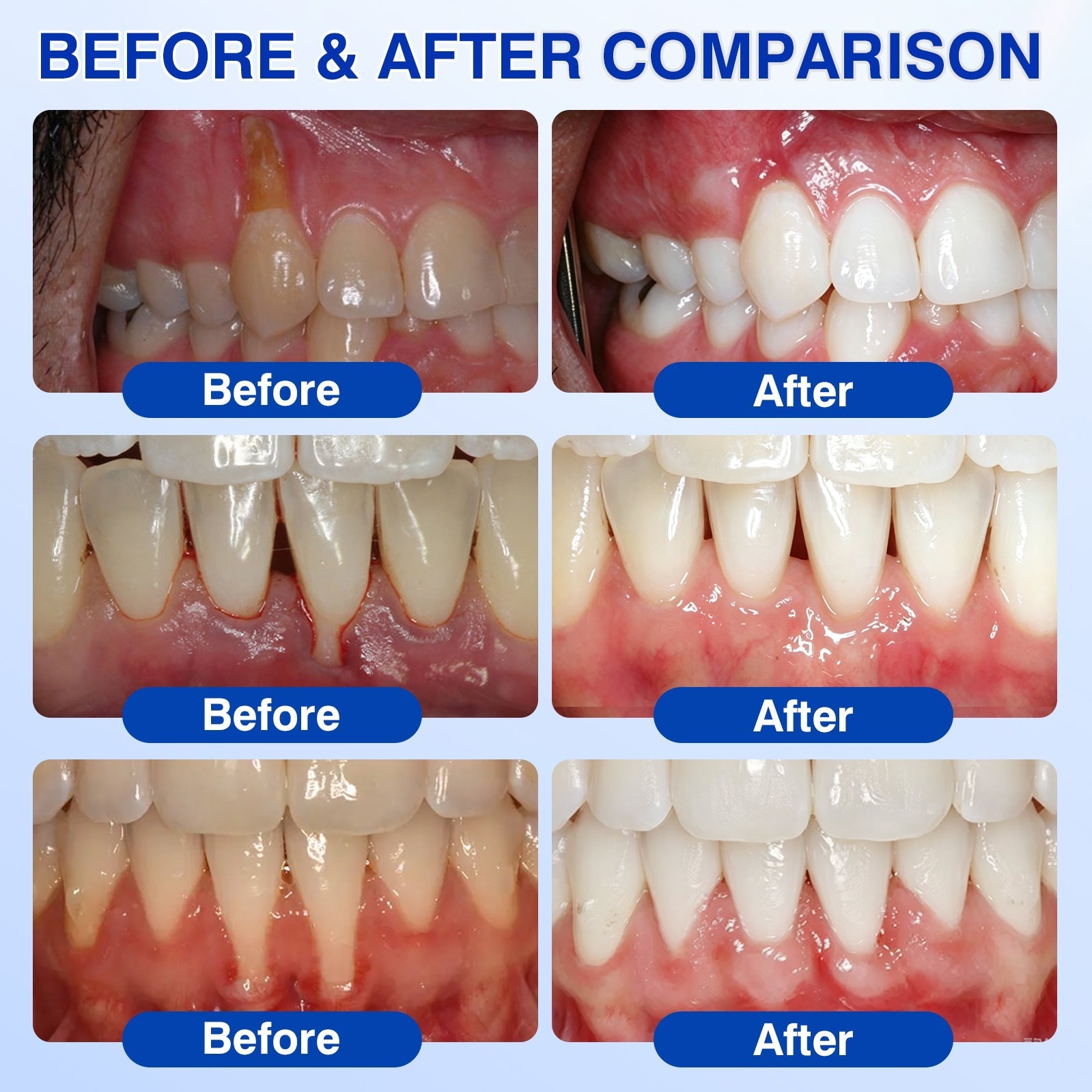 Customer gum before and after example
