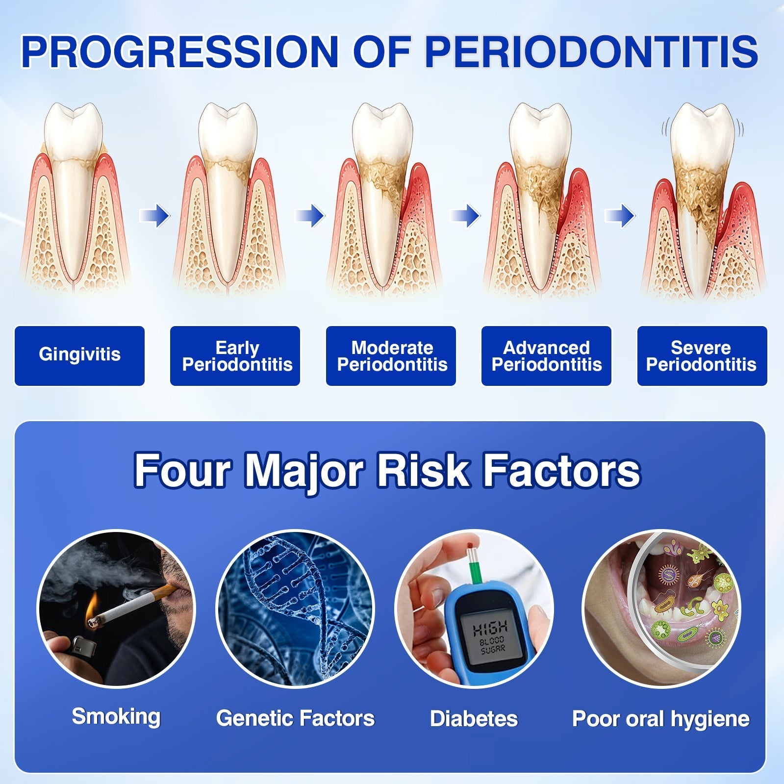 Progression of periodontitis and major risk factors