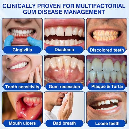👨‍⚕️🦷🛡️GumRevive Periodontal Repair Gel