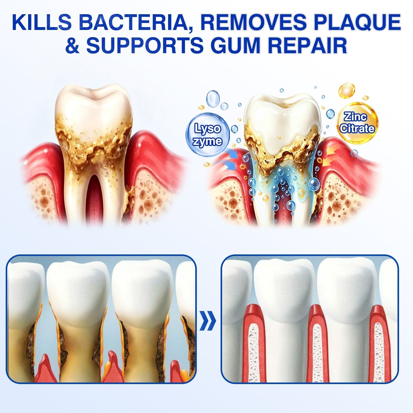 👨‍⚕️🦷🛡️GumRevive Periodontal Repair Gel