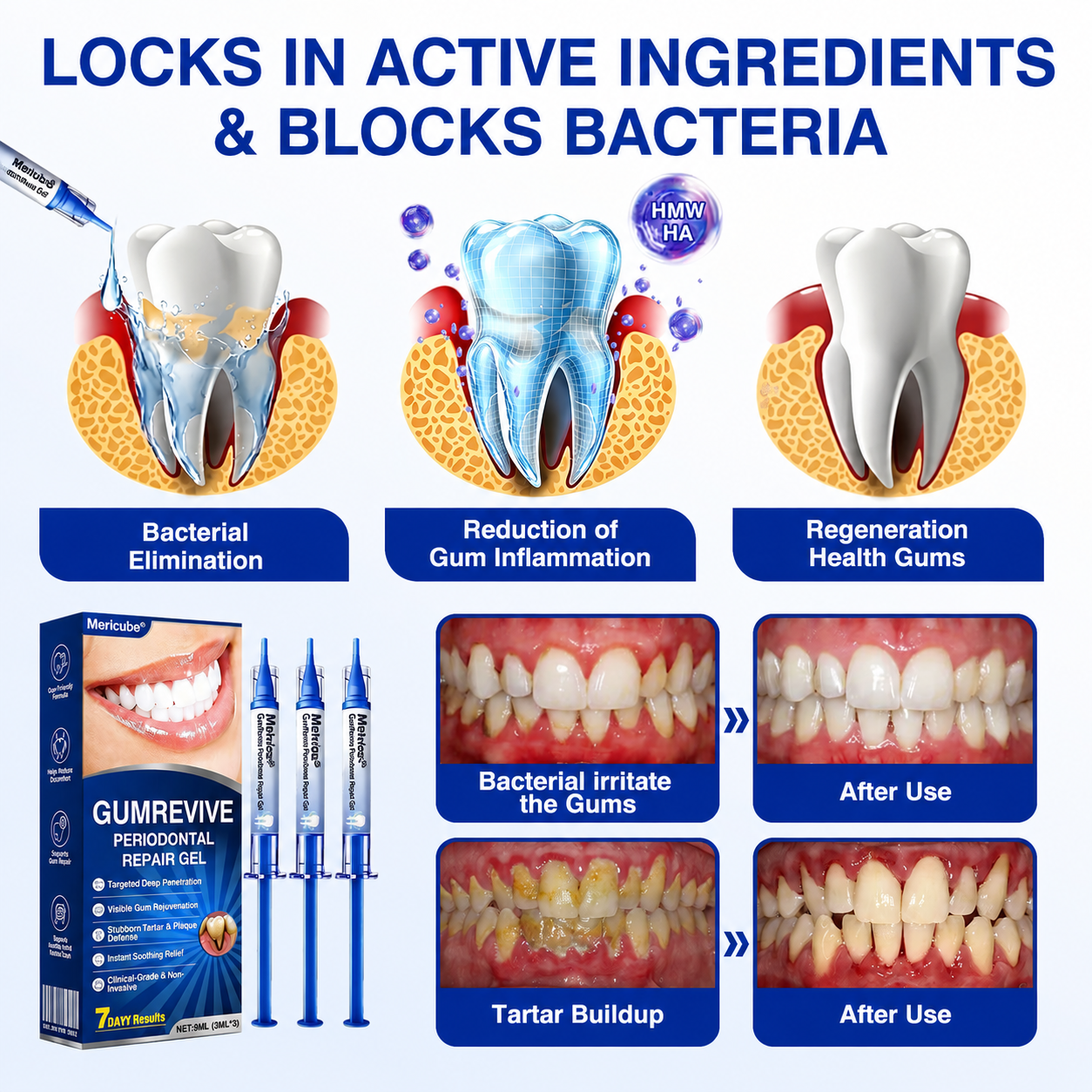 👨‍⚕️🦷🛡️GumRevive Periodontal Repair Gel