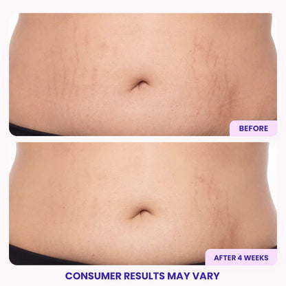 Tighten & Smooth Belly Firming Cream