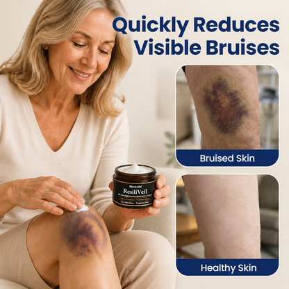 ResiliVeil Bruise Appearance Barrier Care Cream